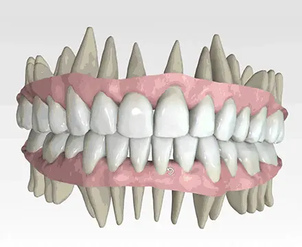 Aparelho fixo e estético